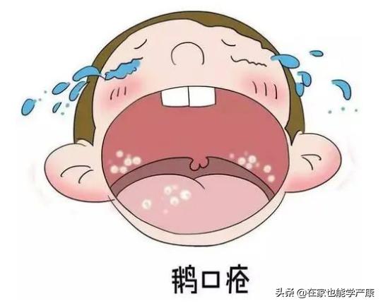 宝宝鹅口疮反复很烦人？试试小儿推拿手法，太有用了！