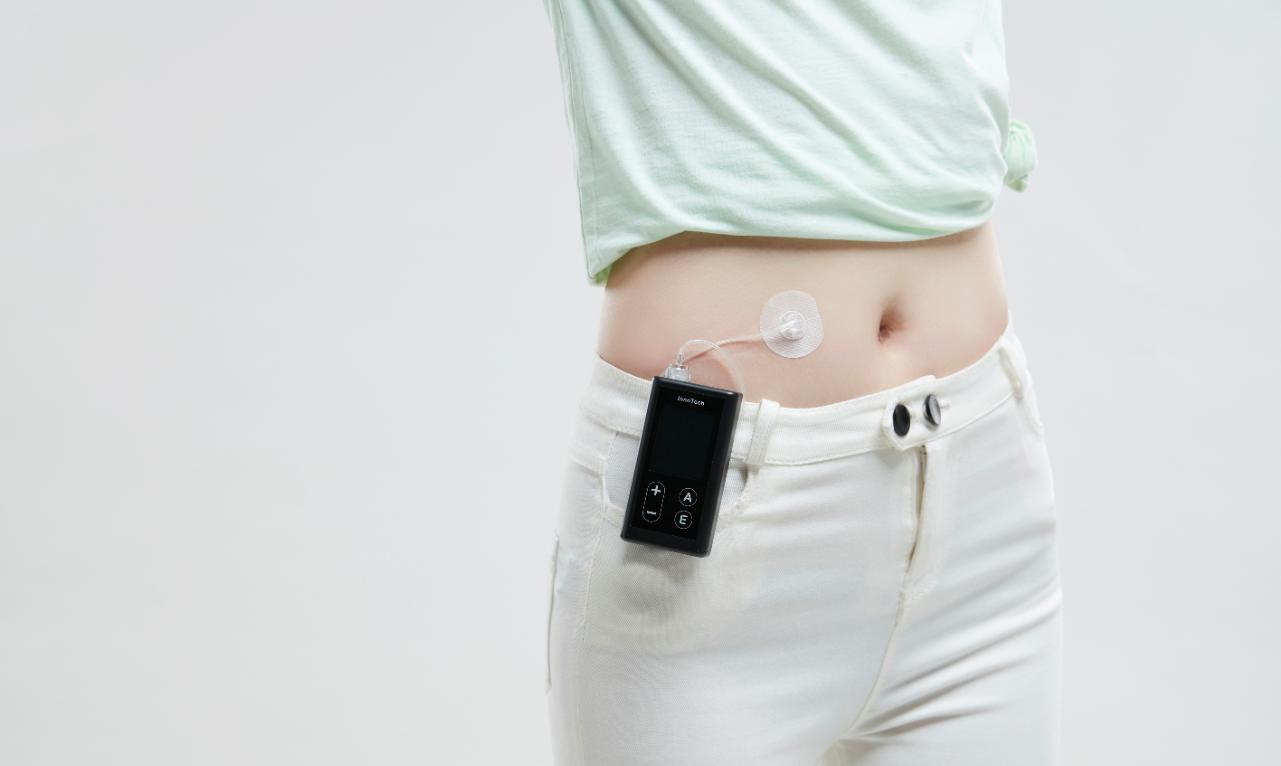 买胰岛素泵需要注意哪些,买胰岛素笔芯要注意什么