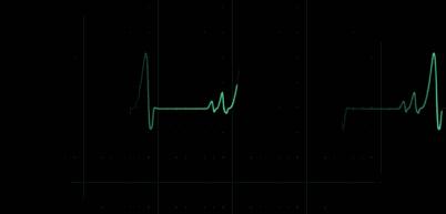 穿高领衣服脖子难受综合征,穿低领也会难受是不是衣领综合征