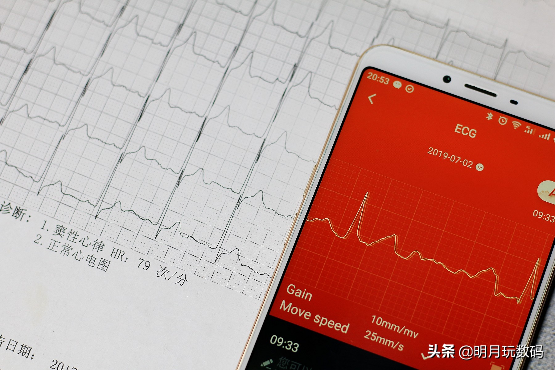 埃微i7e血压手环多少钱,埃微手环测评