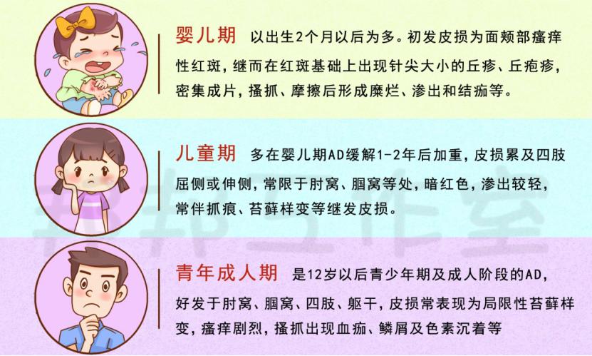 特应性皮炎特效针多少钱一针,儿童特应性皮炎的治疗和护理