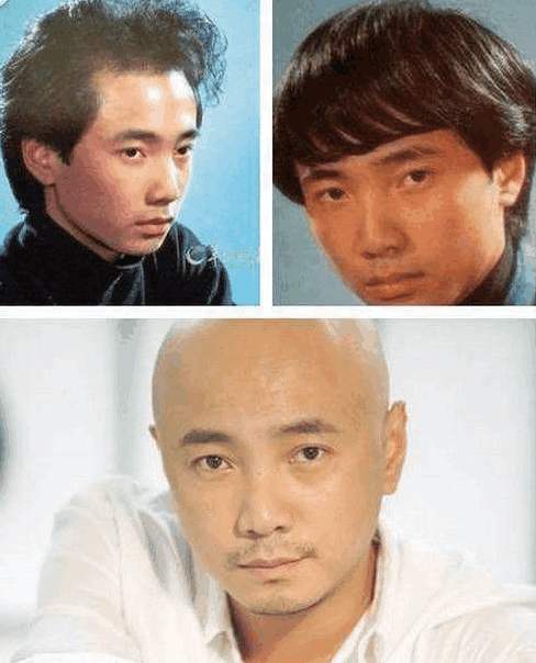 小贝热搜,小贝脱发