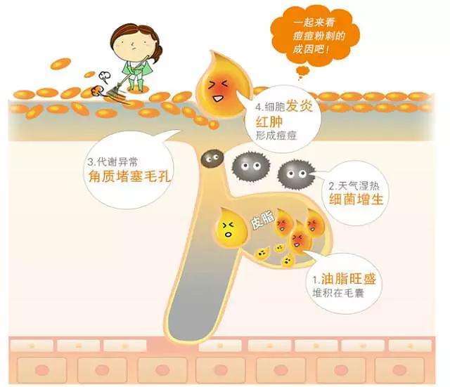 祛痘痘和祛痘印最有效的方法,祛痘淡化痘印妙招男生专用