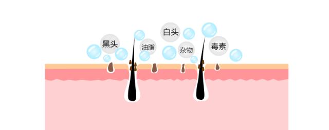 原来去黑头这么简单?干货经验贴