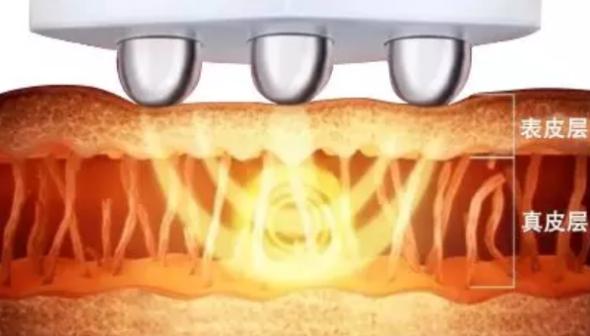 最近很火的美容仪真的有用吗,特别火爆的一款美容仪