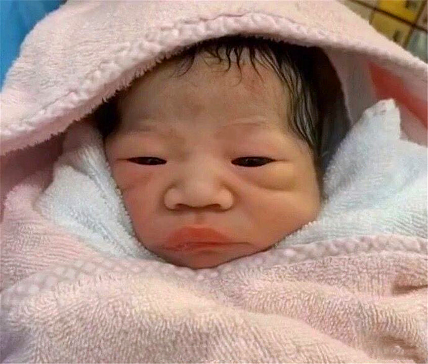 拍彩超胎儿嘴歪,怀孕四维看到孩子嘴歪