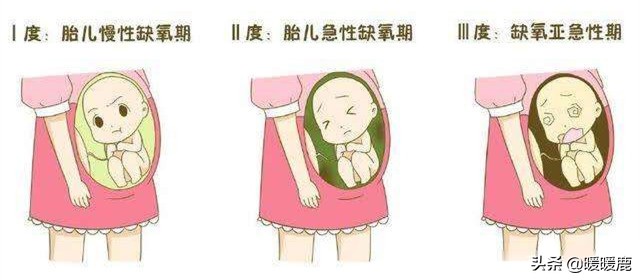 羊水过多的原因分析,羊水浑浊的原因和解决方法