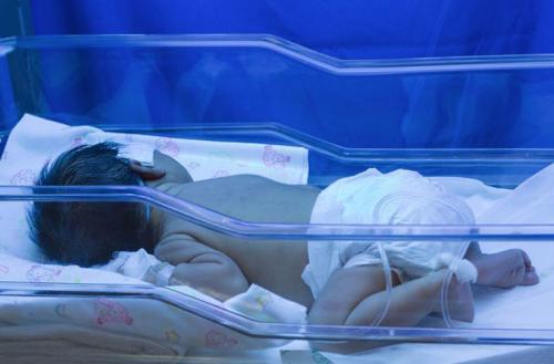 新生儿黄疸出院注意事项,初生婴儿黄疸偏高怎么护理
