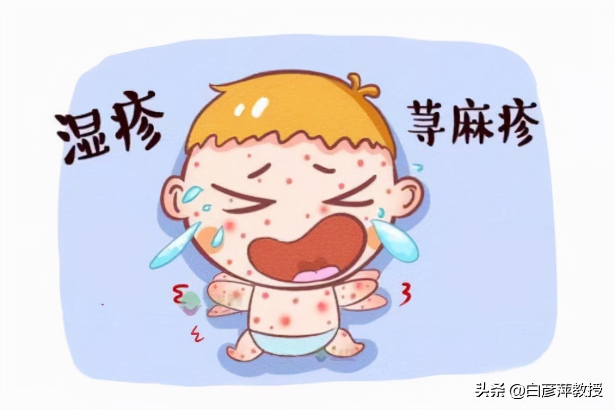 湿疹和荨麻疹症状有什么区别,红疹和湿疹的区别