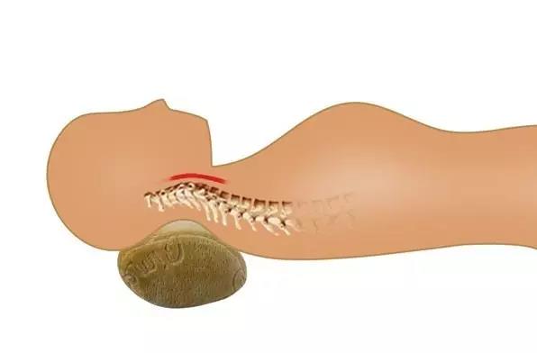 睡觉脖子酸痛是枕头高还是低,怎样选择合适的枕头