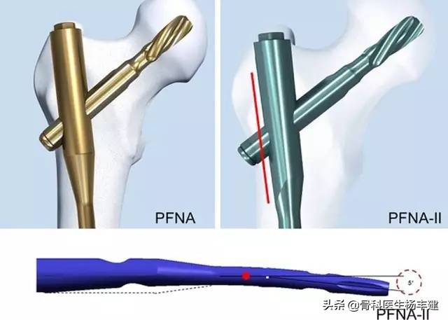 老年人骨折的注意事项九大条，您知道吗？