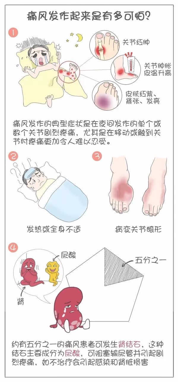 痛风真的有那么可怕吗,痛风到底有多可怕看完全都明白了