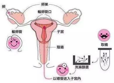 跷二郎腿导致的不孕不育能治好吗,后天性的不育不孕男生可以治好吗