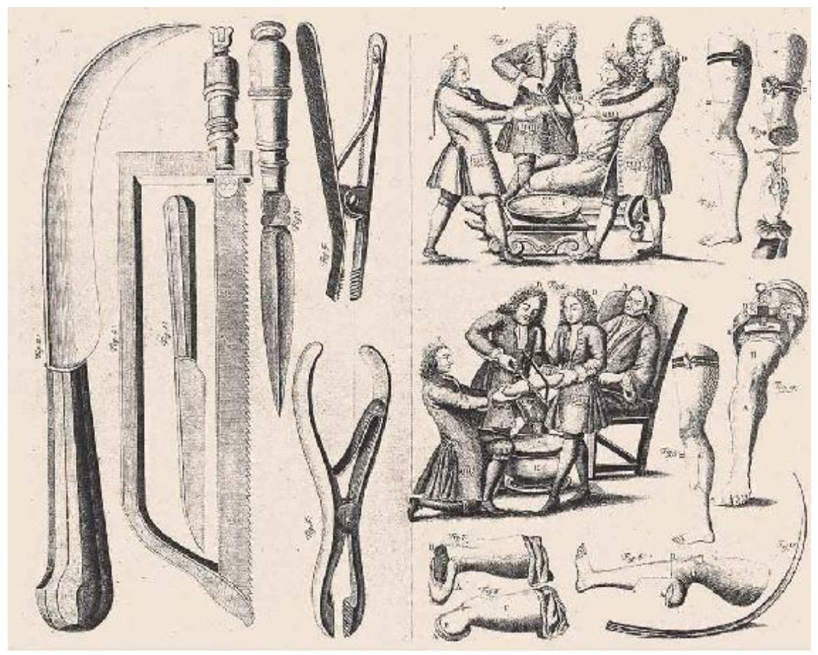 曾经的手术是一场噩梦吗,曾经的心脏手术