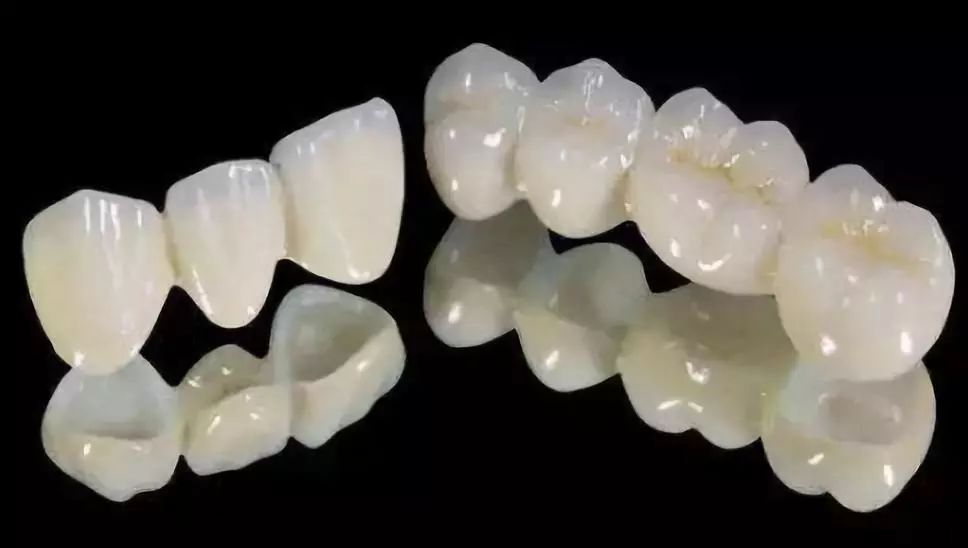 什么情况下牙齿需要做牙冠,牙齿抽掉神经需要戴牙冠吗