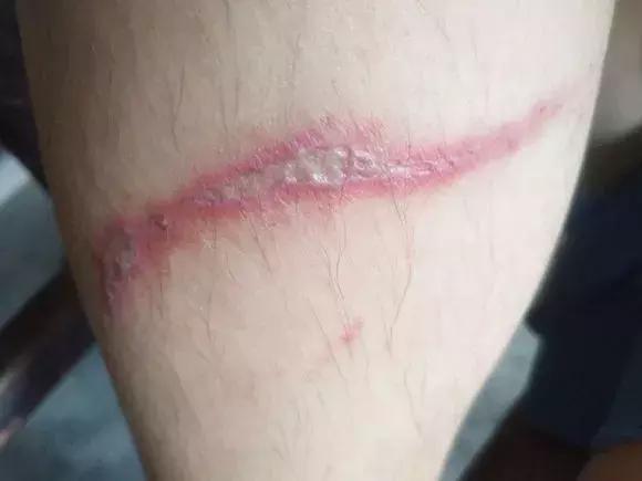 隐形虫出没地方,虫出没名场面