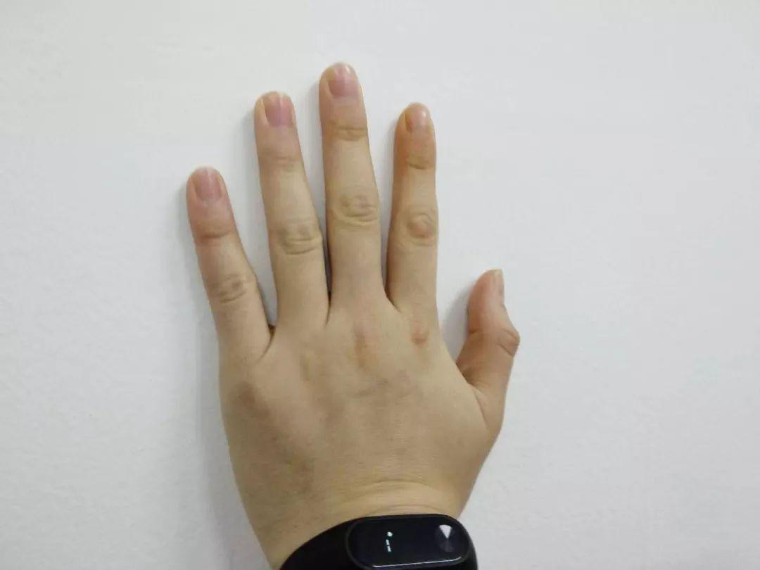 垂体前叶功能减退护理诊断及措施,垂体前叶功能减退症的诊疗流程图