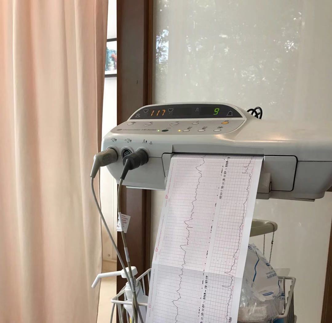 新手妈妈必听孕期检查,孕期必看从怀孕到产后60条建议