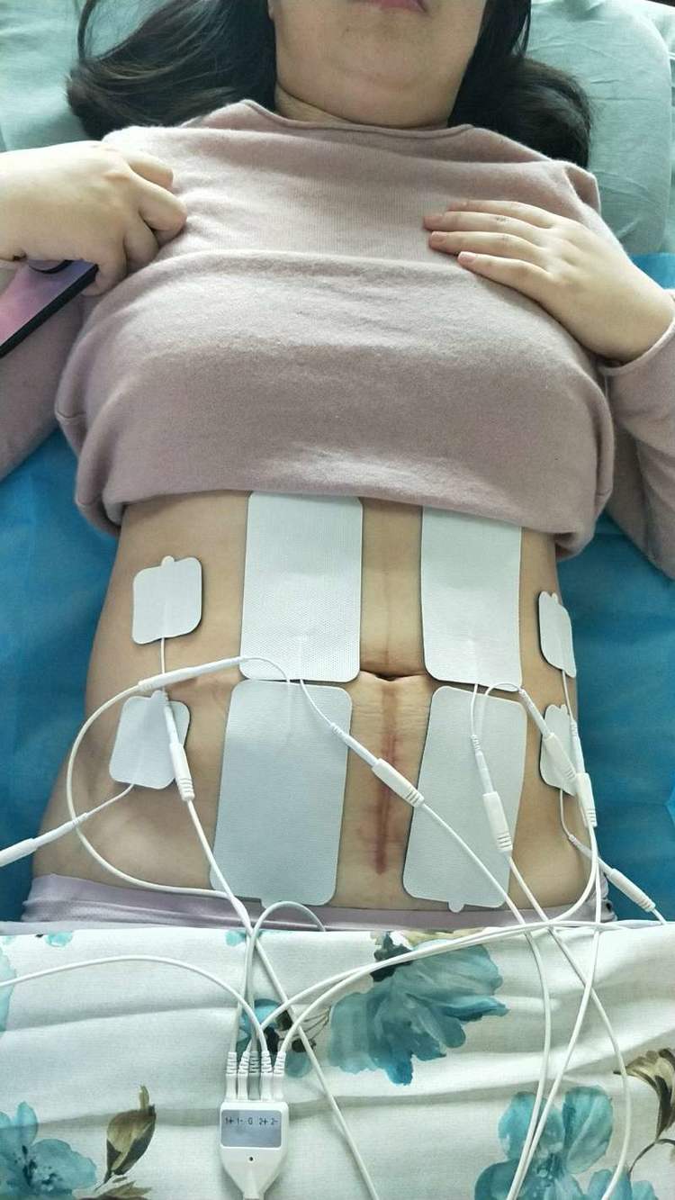 自治区中医院开发区医院产后恢复预约开始啦