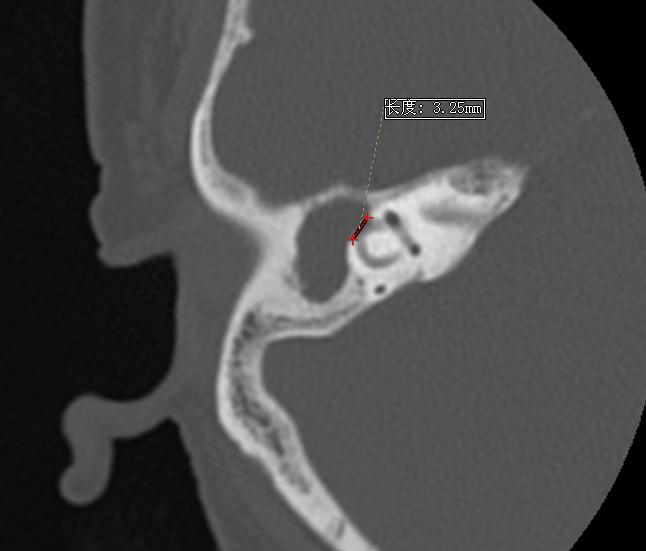 天旋地转是营养不良吗,天旋地转是什么病吃什么药最好