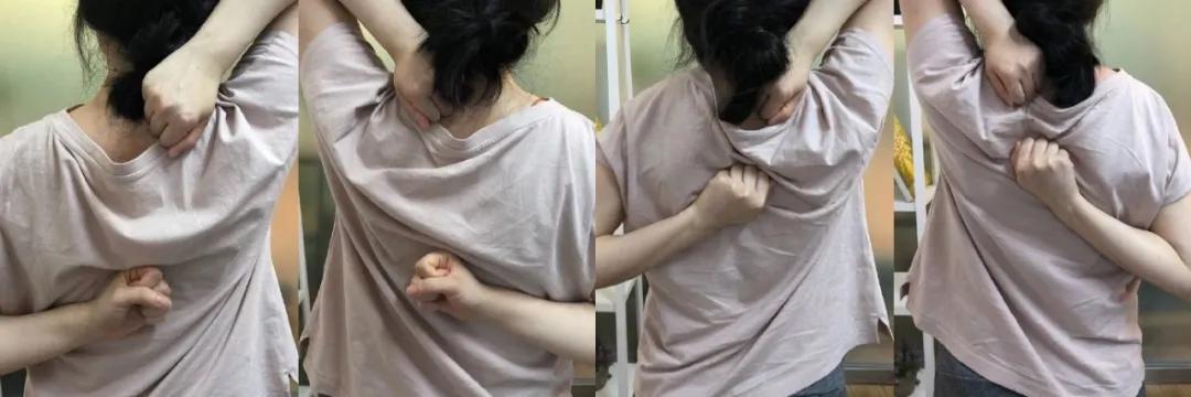 脊柱无侧弯但两侧腰线不对称,两边腰线弧度不一样是脊柱侧弯吗