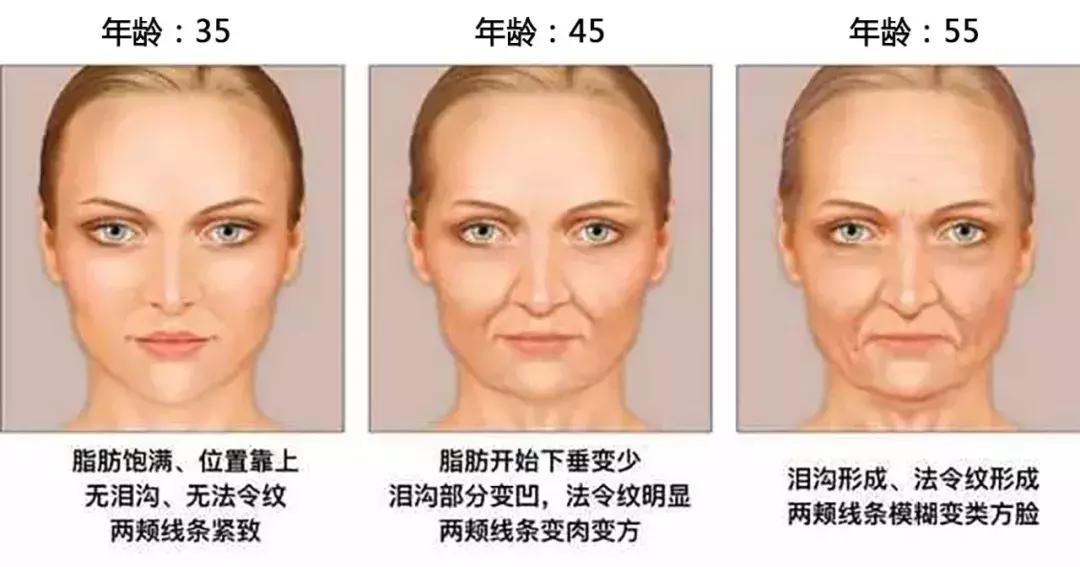 法令纹显老10岁三种方法帮助缓解,有法令纹与没有法令纹显老显凶