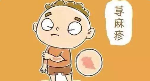 麻疹是由荨麻疹病毒导致的吗,麻疹是皮肤病吗