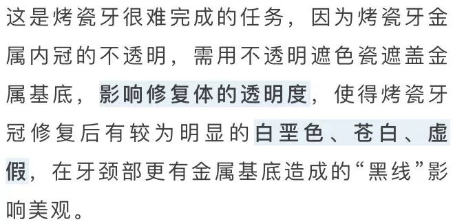烤瓷牙对比全瓷牙有什么优点,烤瓷牙和全瓷牙哪个性价比更高