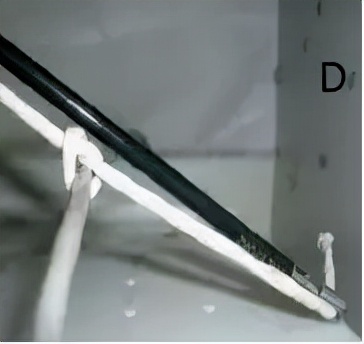 腹腔镜下打结的方法,腹腔镜推结器打结方法视频