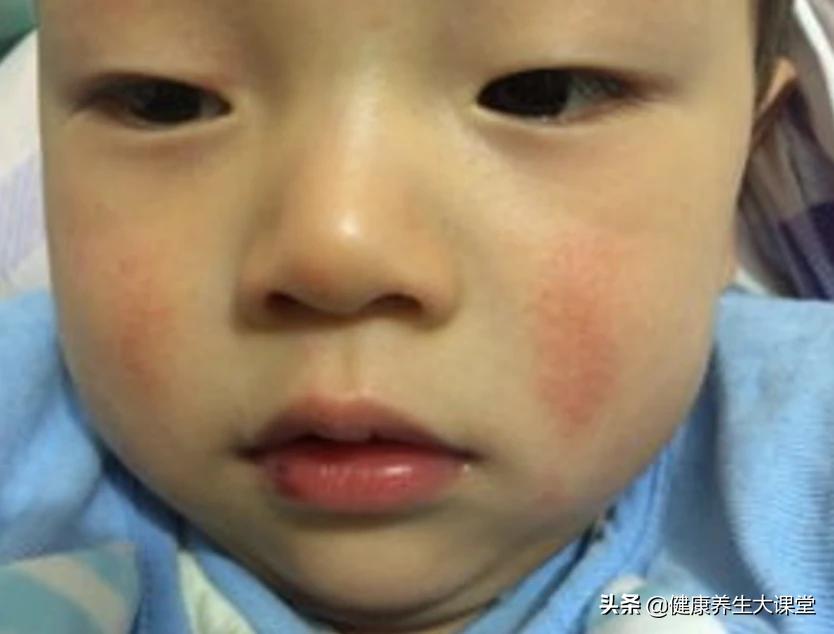 孩子脾虚积食口臭的表现,儿童积食口臭脾胃虚怎么调理中医