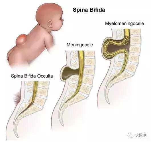 张之瀛大夫推荐的叶酸品牌,哪个品牌叶酸最适合备孕