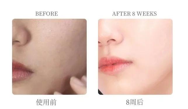 抗初老面膜抗皱保湿平价,抗初老焕白面膜