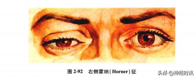 脑干解剖,脑干神经解剖