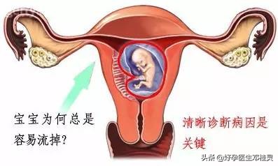 多次胎停育，复发性流产导致不孕？医生：人家经过治疗已经怀孕了