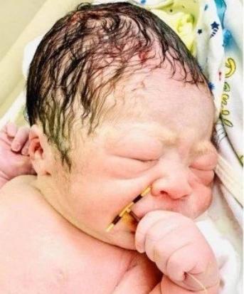 节育器避孕2年多女子仍怀孕，我们应如何避孕