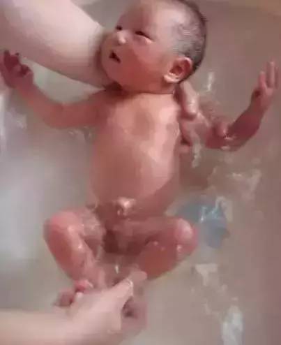 新生儿各种肚脐,新生儿肚脐容易出现的问题