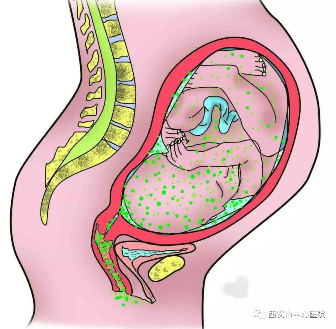 b族链球菌阳性对孩子有什么影响,孕妇b族链球菌阳性打青霉素几天