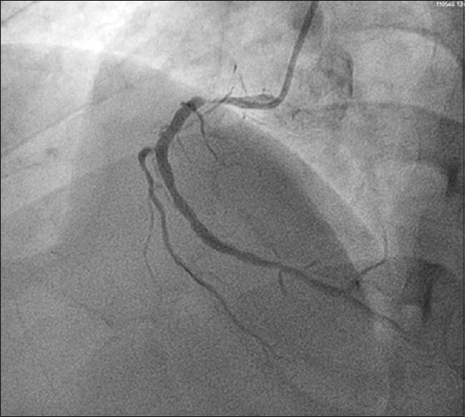 冠心病吃什么药可以增强心脏功能,吃了治冠心病的药总是没劲怎么办