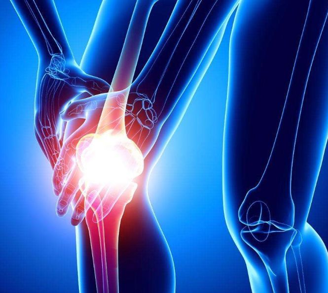 预防关节炎你需要做好4件事,如何有效的保护关节预防关节炎