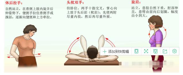 肩周炎五十肩最快的恢复办法,五十肩周炎怎么锻炼