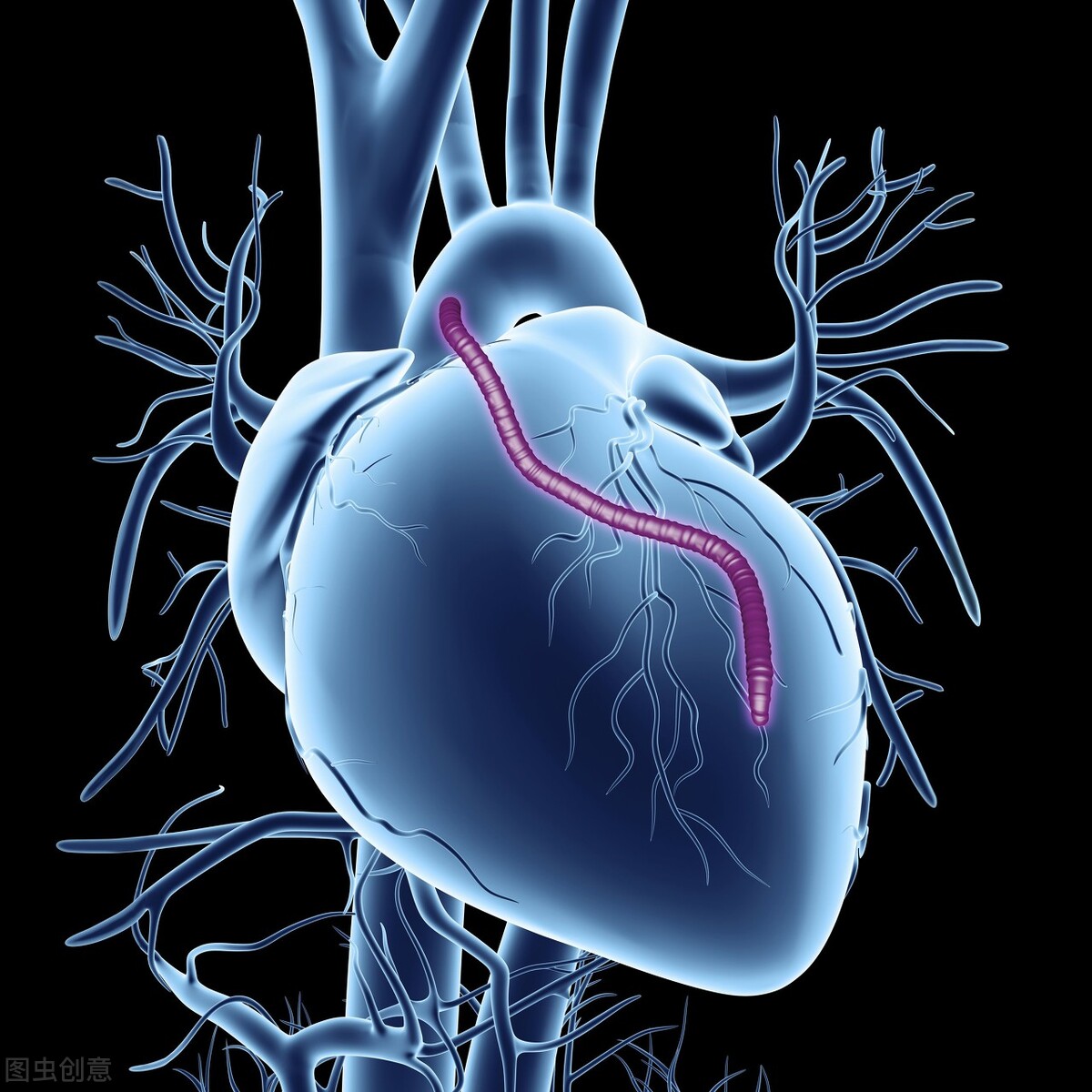 治疗心力衰竭的常用利尿剂,治疗心力衰竭常用的药