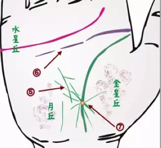 掌纹诊病图片,掌纹能查出糖尿病吗