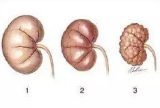 比香烟致癌的食物 (比香烟更毒的危害)