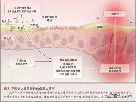 坏死性小肠结肠炎,坏死性的小肠炎症