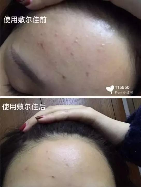 医美爆款面膜,公认最好用的10大网红面膜