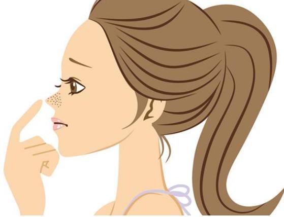 鼻子黑头特别多特别大怎么办,鼻子有黑头怎么办最有效的方法