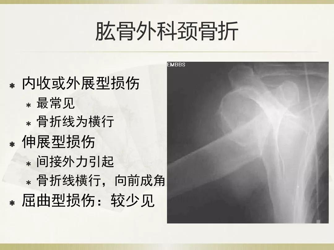 骨科x光片读片技巧,放射科骨科读片教程