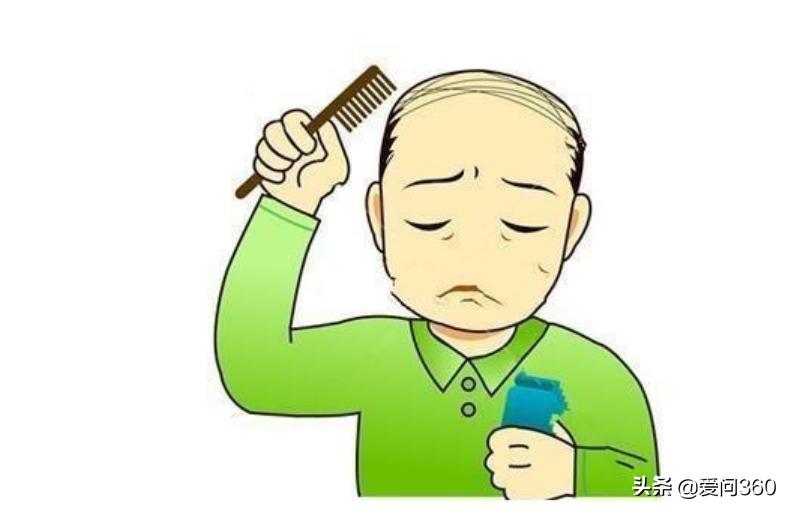 家族性脱发的男生要怎样预防脱发,中年脱发最好补救方法