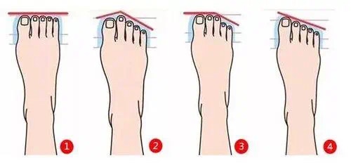 你是什么脚就是什么命,什么样的脚型什么样的命