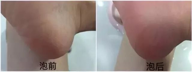 治脚冷的最有效偏方,老中医教你脚暖